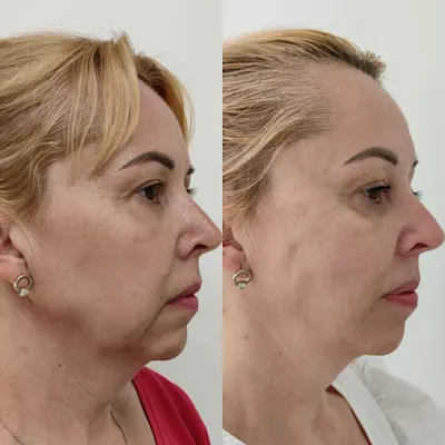 Medycyna Estetyczna Anna Butowska